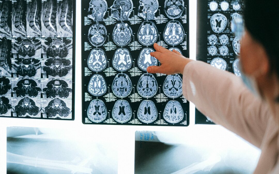 Articles et recherches sur le Neurofeedback