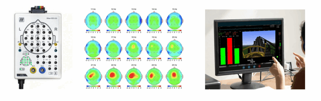 Materiel-neurofeedback-EEGq-2-1024x322